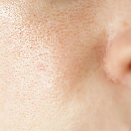 files/Concern-Open-Pores.jpg